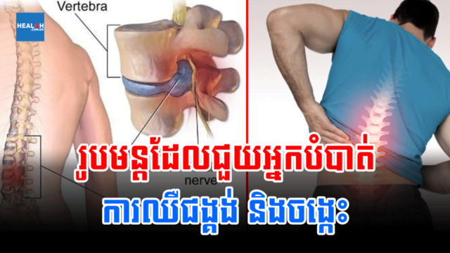 អាការៈឈឺជង្គង់និងចង្កេះបណ្ដាលឲ្យយើងឈឺចុកចាប់បរិវេណក្បាលជង្គង់និងចង្កេះ។ នេះជាបញ្ហាគួរឲ្យរំខានមួយរារាំងដល់ការបំពេញកិច្ចការប្រចាំថ្ងៃ។ រូបថត៖ ទំព័រសុខភាព រូបមន្តជួយឲ្យបាត់ការឈឺជង្គង់និងចង្កេះ ảnh 1