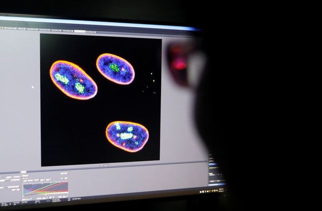 អ្នកវិទ្យាសាស្ត្រ​ ចិន​ អភិវឌ្ឍ​ការព្យាបាល​ហ្សែ​នដែល​អាច​ពន្យារ​ភាព​ចាស់​និង​បន្លាយ​អាយុ​