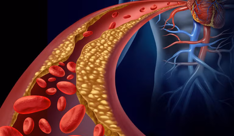 ជាតិខ្លាញ់នៅក្នុងឈាម អាចទប់ស្កាត់និងលុបបំបាត់បន្តិចម្តងៗ ប្រសិនបើអ្នកឧស្សាហ៍ទទួលទានអាហារទាំង ៥ ប្រភេទដូចបានរៀបរាប់ខាងក្រោម។ រូបថតពី៖ Health.com.kh