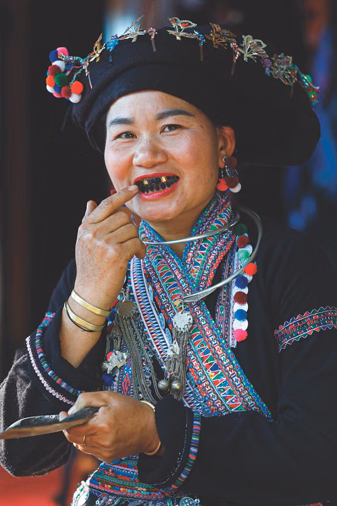 nhuon rang 2.jpg
